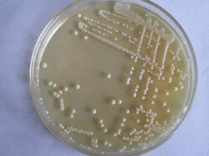 <b>The storage of recycled yeast</b>